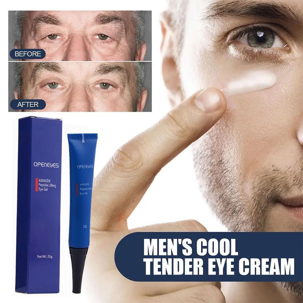1+1 GRATIS CREMA PARA OJERAS- OPENEYES™