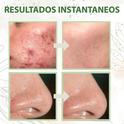 NO MÁS PUNTOS NEGROS: Máscara Té Verde Natural