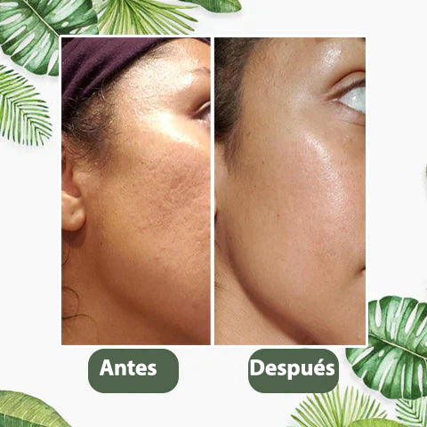 NO MÁS PUNTOS NEGROS: Máscara Té Verde Natural