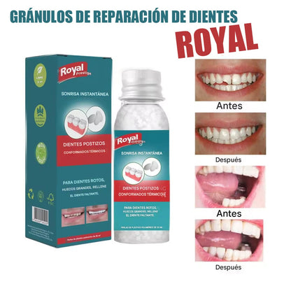 PLACAS FLEXIBLES REPARADORAS DE DIENTES - ROYAL™