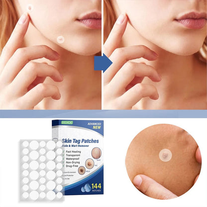 SKIN TAG™ - PARCHES PARA LA PIEL